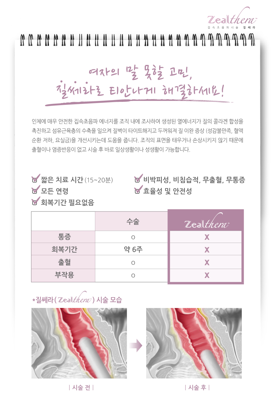 질세라